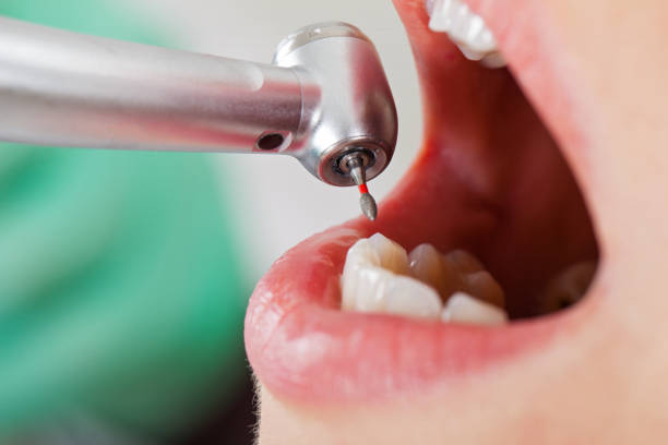 Best Emergency Broken Tooth Repair in Buena, NJ